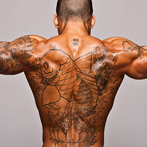 Remoción de tatuajes