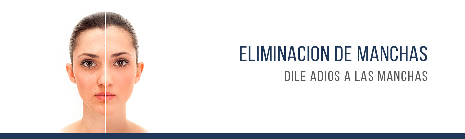 eliminacion_de_manchas